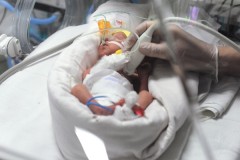Женщина родила близнецов с разницей в 2,5 месяца